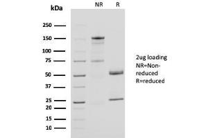 Image no. 1 for anti-CD40 Ligand (CD40LG) (AA 108-261) antibody (ABIN6941188)