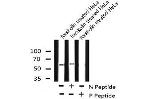 Image no. 5 for anti-Caspase 8 (CASP8) (pTyr448) antibody (ABIN6271372)