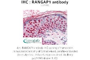 Image no. 1 for anti-Ran GTPase Activating Protein 1 (RANGAP1) antibody (ABIN1738728)
