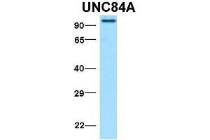 Image no. 6 for anti-Sad1 and UNC84 Domain Containing 1 (SUN1) (N-Term) antibody (ABIN2783971)