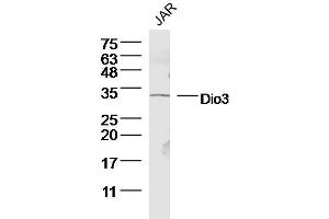 Image no. 3 for anti-Deiodinase, Iodothyronine, Type III (DIO3) antibody (ABIN750883)