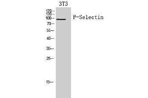 Image no. 1 for anti-Selectin P (Granule Membrane Protein 140kDa, Antigen CD62) (SELP) (Internal Region) antibody (ABIN3188020)