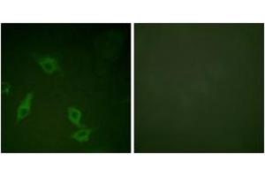 Image no. 3 for anti-PTK2 Protein tyrosine Kinase 2 (PTK2) (AA 363-412) antibody (ABIN1532612)