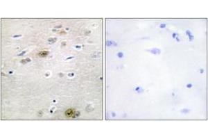 Image no. 2 for anti-Transformer 2 alpha Homolog (TRA2A) (AA 221-270) antibody (ABIN1533877)
