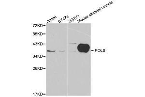 Image no. 3 for anti-Polymerase (DNA Directed), beta (POLB) antibody (ABIN3022385)