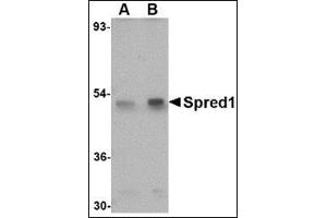Image no. 2 for anti-Sprouty-Related, EVH1 Domain Containing 1 (SPRED1) (Center) antibody (ABIN500796)