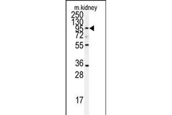 ADAM9 antibody  (N-Term)