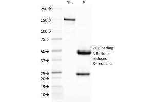 Image no. 5 for anti-CD209 (CD209) antibody (ABIN6939610)