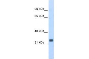Image no. 1 for anti-Ets Homologous Factor (EHF) antibody (ABIN2462031)