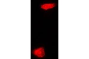 Image no. 1 for anti-Phytanoyl-CoA Dioxygenase Domain Containing 1 (PHYHD1) antibody (ABIN2966905)
