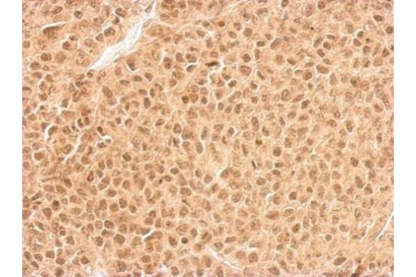 RPL11 antibody  (Center)