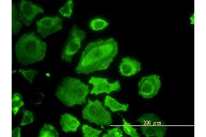 Image no. 5 for anti-Cell Division Cycle 37 Homolog (S. Cerevisiae) (CDC37) (AA 1-378) antibody (ABIN564833)