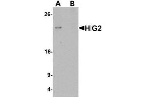 Image no. 1 for anti-Hypoxia Inducible Lipid Droplet-Associated (HILPDA) (C-Term) antibody (ABIN1450090)