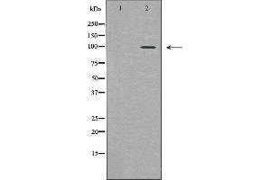 Image no. 2 for anti-Promyelocytic Leukemia (PML) (N-Term) antibody (ABIN6264315)