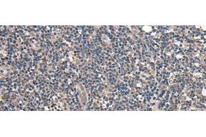 Immunohistochemistry of paraffin-embedded Human tonsil tissue using BRI3BP Polyclonal Antibody at dilution of 1:35(x200)