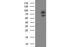 Image no. 1 for anti-Oxysterol Binding Protein-Like 11 (OSBPL11) antibody (ABIN1499922)