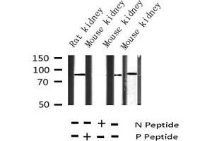 Image no. 4 for anti-Cortactin (CTTN) (pTyr466) antibody (ABIN6256746)