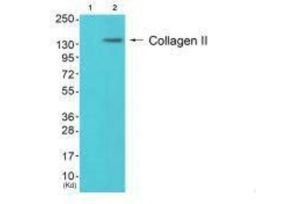 COL2A1 antibody