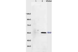 Image no. 2 for anti-Mitogen-Activated Protein Kinase-Activated Protein Kinase 5 (MAPKAPK5) (pThr182) antibody (ABIN710546)