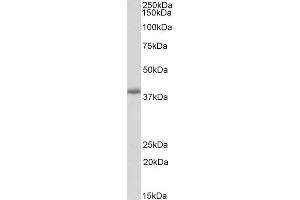 Image no. 1 for anti-PDZ and LIM Domain 2 (PDLIM2) (Internal Region) antibody (ABIN5539902)