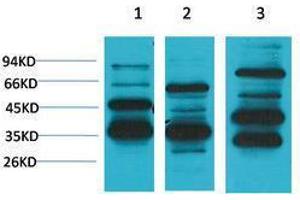 Image no. 1 for anti-MAS1 Oncogene (MAS1) antibody (ABIN3181533)