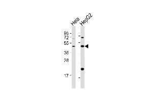 Image no. 2 for anti-E2F Transcription Factor 2 (E2F2) (AA 258-286) antibody (ABIN654438)