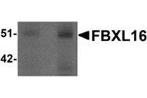 Image no. 1 for anti-F-Box and Leucine-Rich Repeat Protein 16 (FBXL16) (C-Term) antibody (ABIN783375)