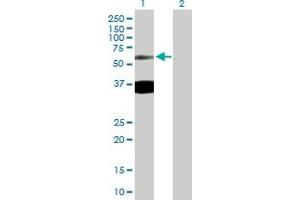 Image no. 1 for anti-tau Tubulin Kinase 2 (TTBK2) (AA 1-478) antibody (ABIN530907)