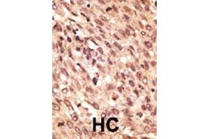 Image no. 2 for anti-Low Density Lipoprotein Receptor-Related Protein 5 (LRP5) (AA 1538-1567), (C-Term) antibody (ABIN390099)