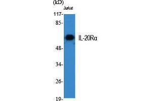 Image no. 2 for anti-Interleukin 20 Receptor alpha (IL20RA) (Internal Region) antibody (ABIN3185168)