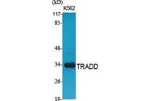 Image no. 2 for anti-TNFRSF1A-Associated Via Death Domain (TRADD) (C-Term) antibody (ABIN3187319)