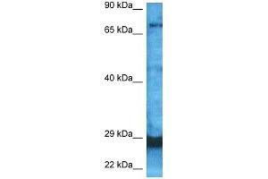 Image no. 6 for anti-F-Box and WD Repeat Domain Containing 7 (FBXW7) (C-Term) antibody (ABIN2782955)