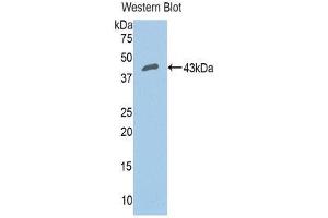 Image no. 1 for anti-Complement Factor B (CFB) (AA 35-160) antibody (ABIN1858372)