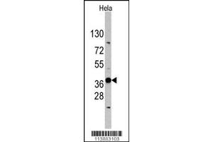 Western Blotting (WB) image for anti-Ectodysplasin A (EDA) antibody (ABIN2158632)