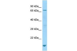 Image no. 1 for anti-Premature Ovarian Failure, 1B (POF1B) (N-Term) antibody (ABIN2790494)