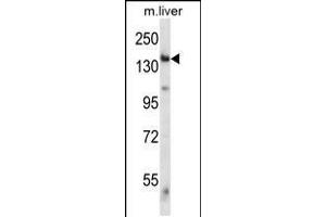 Image no. 1 for anti-Eukaryotic Translation Initiation Factor 2 alpha Kinase 4 (EIF2AK4) (AA 1477-1504), (C-Term) antibody (ABIN5531092)