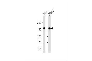 Image no. 1 for anti-Fms-Related Tyrosine Kinase 4 (FLT4) (AA 1-439) antibody (ABIN1882290)