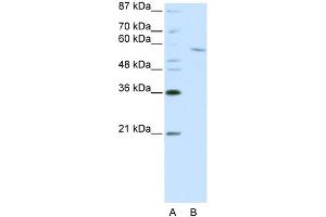 Image no. 1 for anti-REST Corepressor 1 (RCOR1) (C-Term) antibody (ABIN2780966)