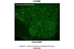 Image no. 5 for anti-Potassium Intermediate/small Conductance Calcium-Activated Channel, Subfamily N, Member 2 (KCNN2) (C-Term) antibody (ABIN2776144)