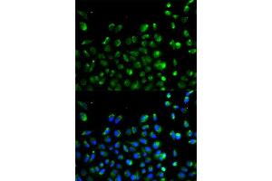 Image no. 6 for anti-Autophagy Related 13 (ATG13) antibody (ABIN3021088)