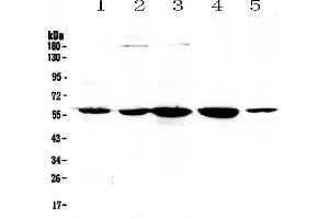 Image no. 1 for anti-Ets Variant 6 (ETV6) (AA 327-448) antibody (ABIN5693220)