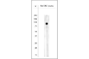 Image no. 5 for anti-Transient Receptor Potential Cation Channel, Subfamily V, Member 1 (TRPV1) (4th Cytoplasmic Loop) antibody (ABIN351249)