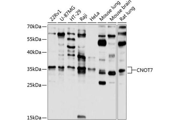 CNOT7 Antikörper  (AA 90-160)