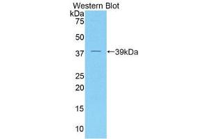Image no. 1 for anti-Dickkopf Homolog 4 (Xenopus Laevis) (DKK4) (AA 37-141) antibody (ABIN1858646)