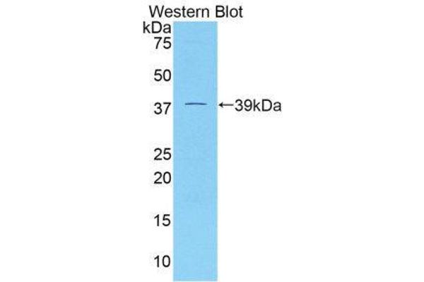 anti-Dickkopf Homolog 4 (Xenopus Laevis) (DKK4) (AA 37-141) antibody