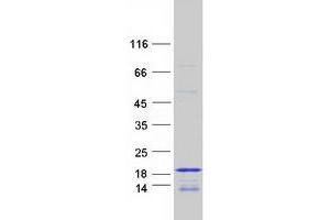 Image no. 1 for Histone Cluster 3, H2bb (HIST3H2BB) protein (Myc-DYKDDDDK Tag) (ABIN2722816)