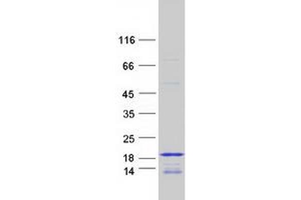 HIST3H2BB Protein (Myc-DYKDDDDK Tag)