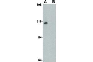 Image no. 2 for anti-Junctophilin 3 (JPH3) (Internal Region) antibody (ABIN6656240)