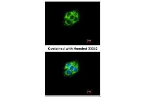 ICC/IF Image Immunofluorescence analysis of methanol-fixed Hep G2, using ABAT, antibody at 1:500 dilution.