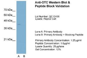 Image no. 3 for anti-Ornithine Carbamoyltransferase (OTC) (N-Term) antibody (ABIN2773791)